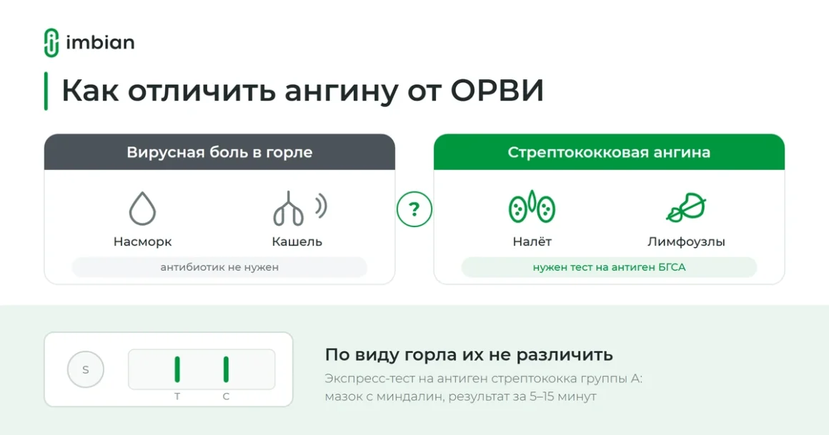 Как отличить стрептококковую ангину от вирусной боли в горле