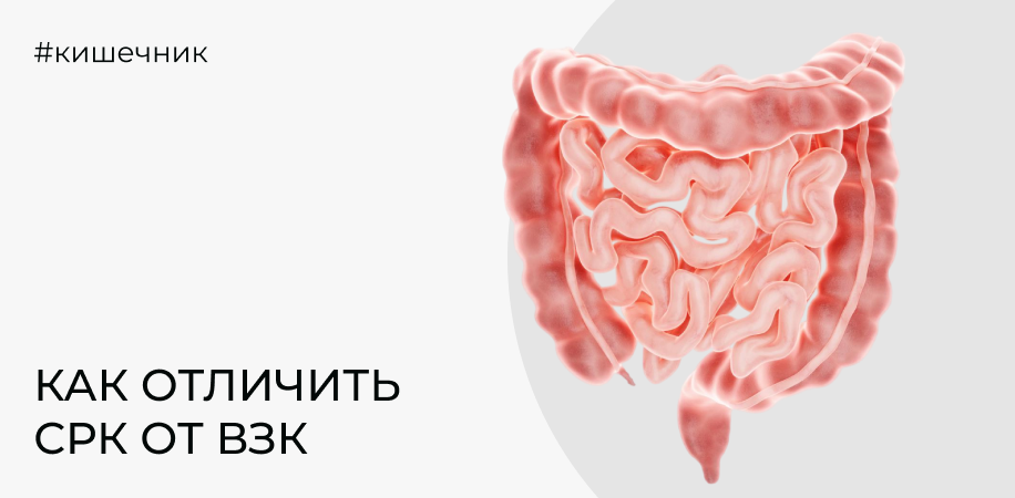 Как отличить СРК от воспалительного заболевания кишечника